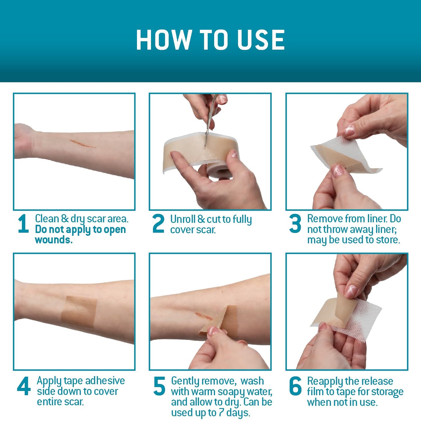 Care Science Silicone Scar Tape 1.6 x 120in 1ct | Scar Tape for Surgical Scars, Keloid, Stretch Marks Removal, C-Section, Burn, Tummy Tuck, Reusable Medical Grade