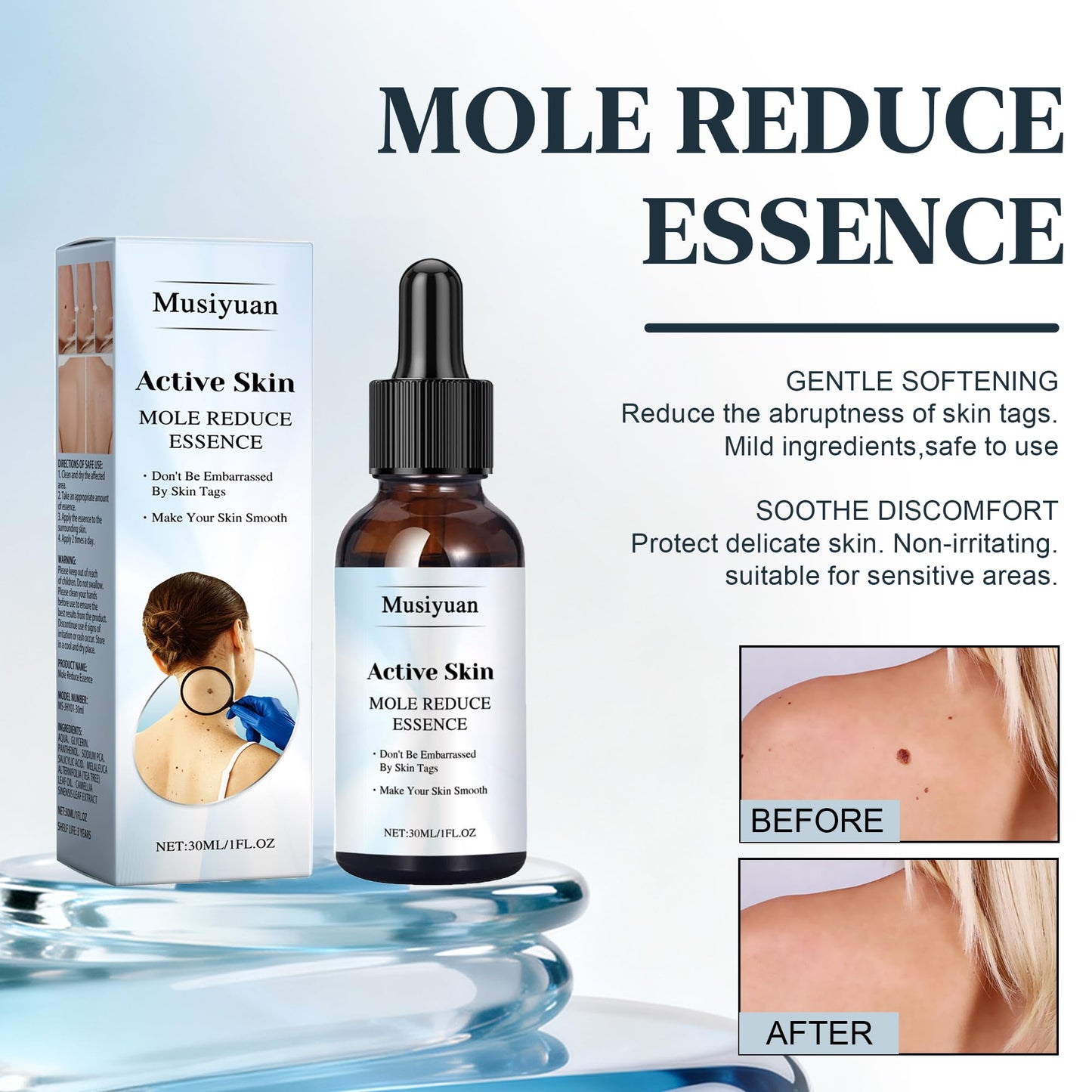 Musiyuan Facial and body mole and skin growth removal serum – fast-acting, precise dropper design effectively removes various warts (30ml)