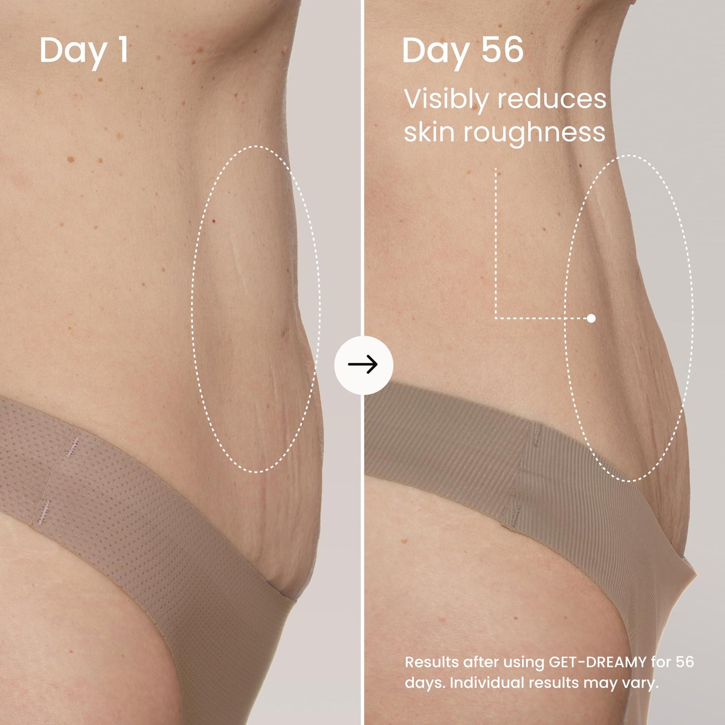MAËLYS GET-DREAMY Overnight Toning Whip, 2 Pack