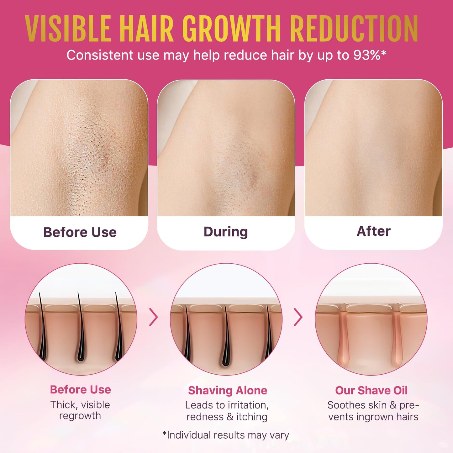 KITNOBLIS After Shave Oil Women for Smooth Skin, Strawberry Shaving Oil with Peptides & Hyaluronic Acid - Razor Bump Prevention & Anti-Aging Treatment for Ingrown Hair, Hydration & Soothing (50 ML)