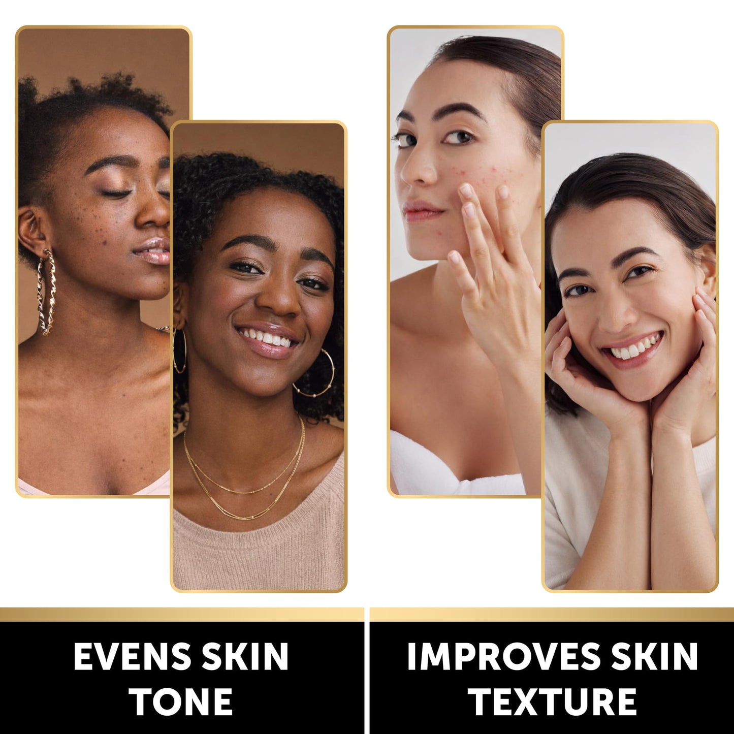 VALITIC Brightening Lemon & Turmeric Kojic Acid Soap with Vitamin C, Retinol, Collagen - Original Japanese Complex - with Hyaluronic Acid, Vitamin E, Shea Butter - Dark Spot Corrector 2 Pack & Holder