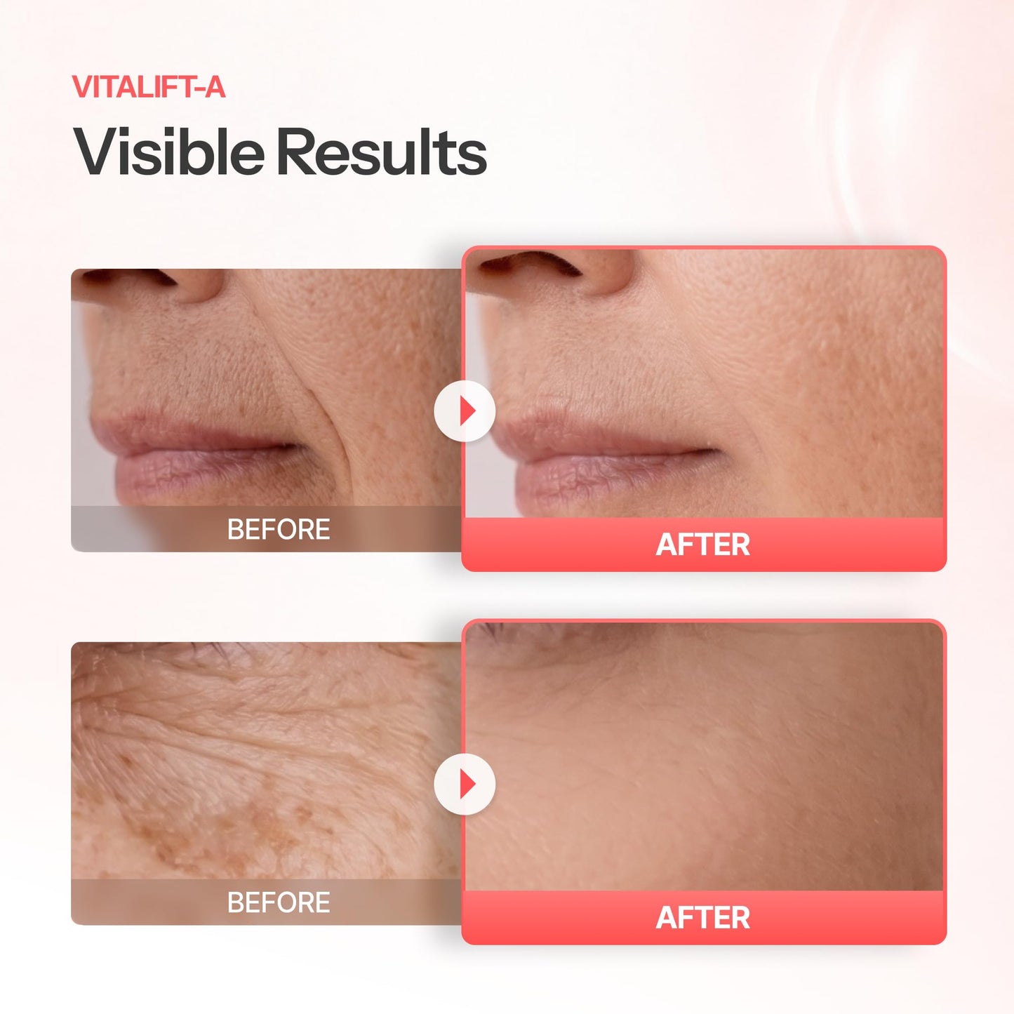 Dr.Different VITALIFT-A Retinal 0.05% - Anti-Aging And Anti-Wrinkle Night Treatment For Lifting And Firming-Face Moisturizer Cream With Vitamin A & Hyaluronic Acid, 0.7oz.