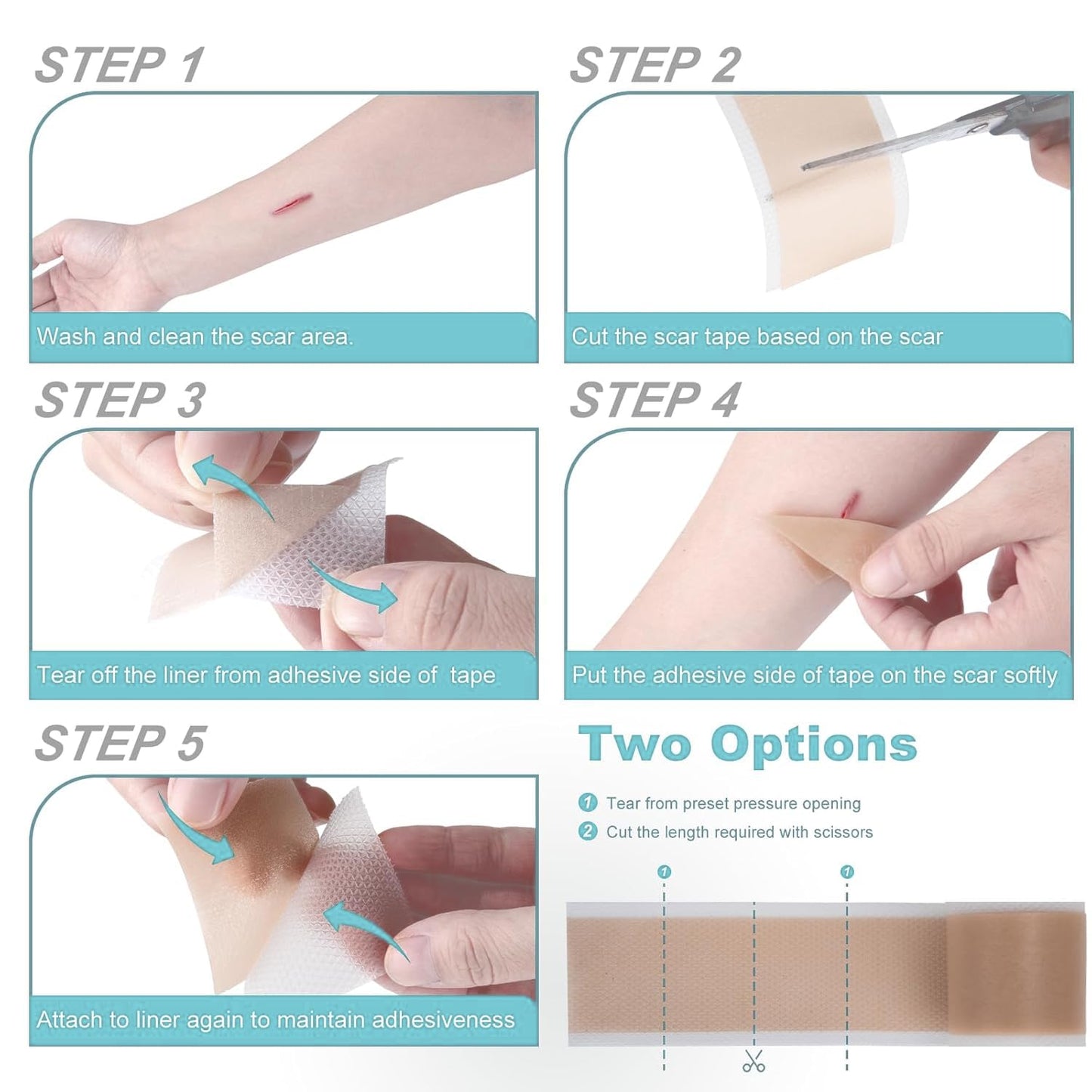 Silicone Scar Tape/Sheets for Surgical Scars, (1.6" x 59") Silicone Scar Removal Strips for Surgical, C-Section, Tummy Tuck, Keloid Scars Keloid Bump Removal (4cm x 1.5M)