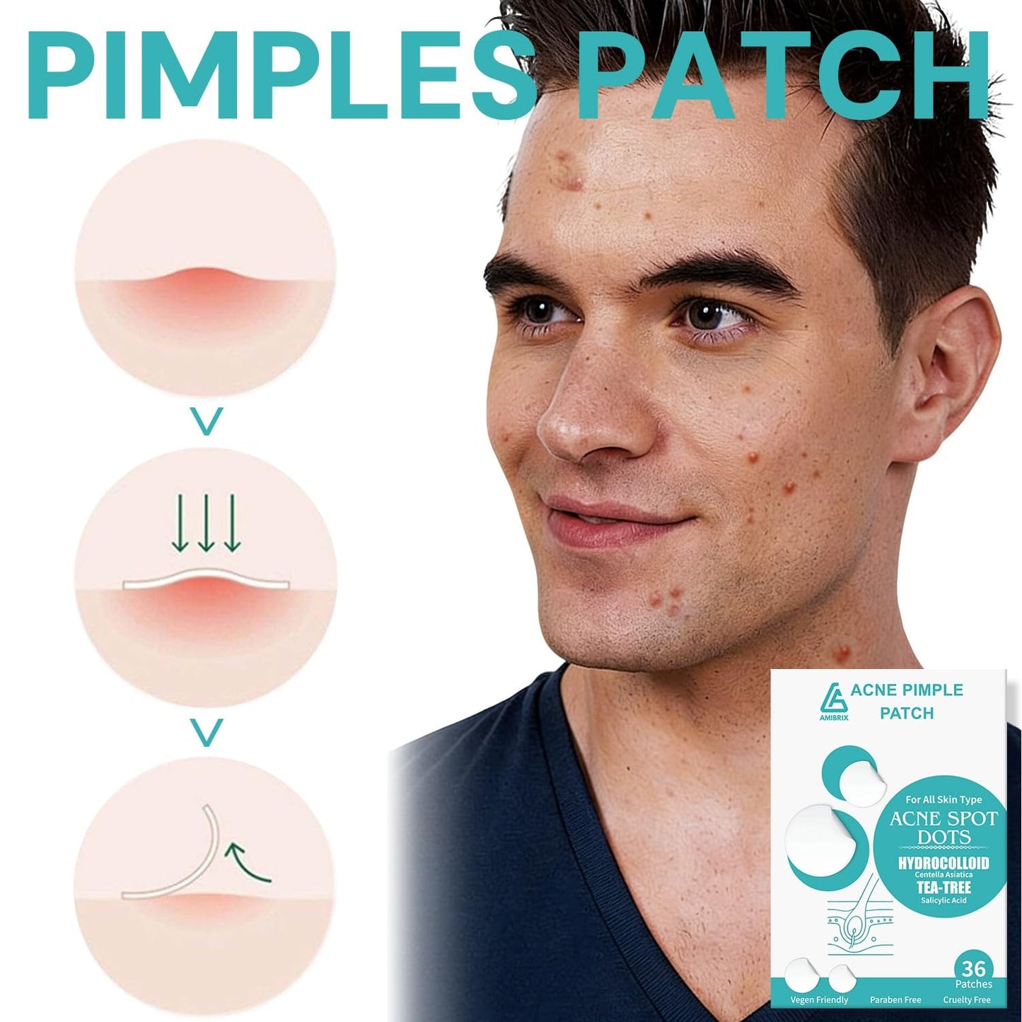 Hydrocolloid Acne Pimple Patches for Face – Nighttime Spot Stickers for Zits & Blemishes, Acne Healing Dots with Salicylic Acid, Korean Skincare Spot Treatment,Suitable Under Makeup