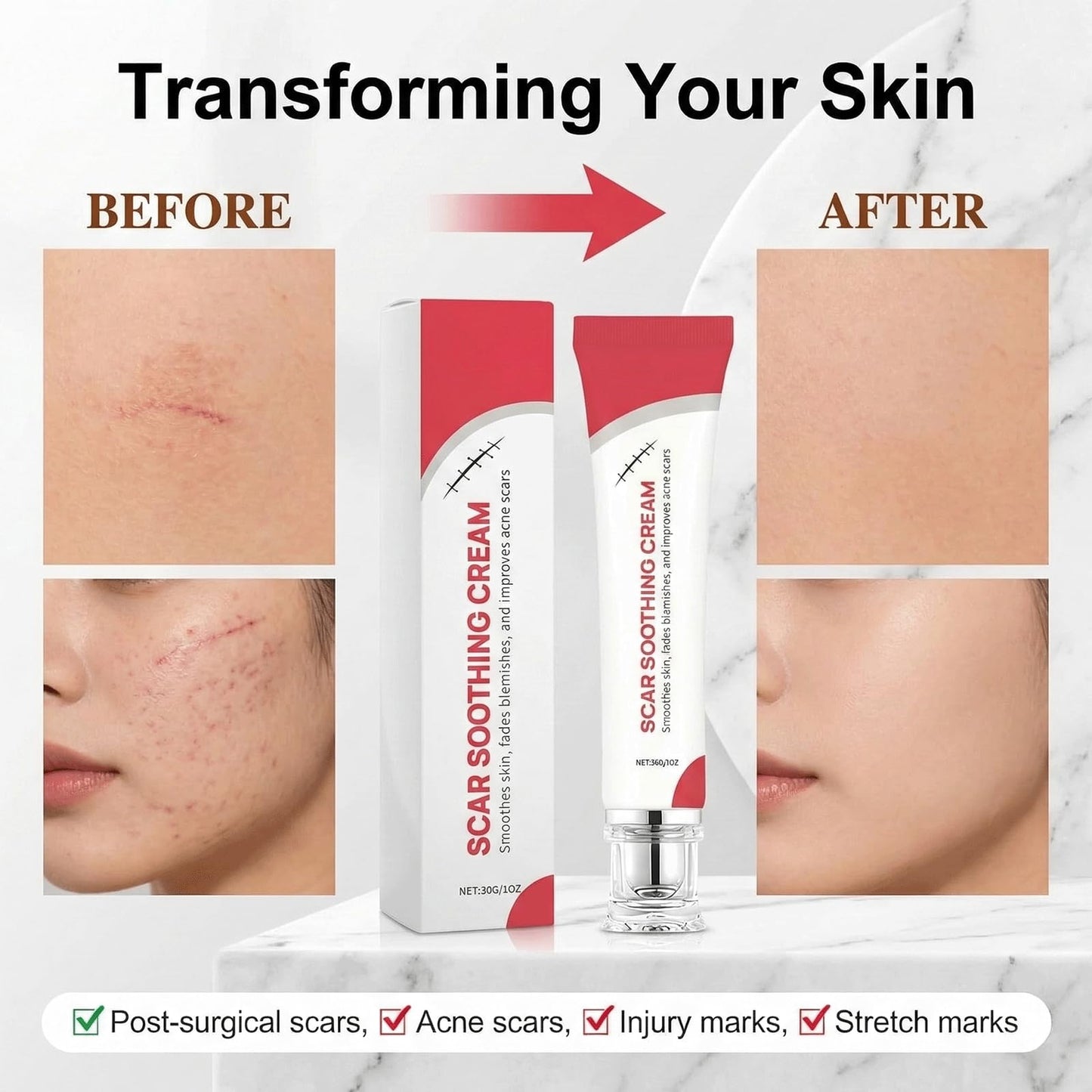Novacarax Scar Soothing Cream & Smoothing Cream for Scars,Helps Improve Appearance for Surgical Scars and Keloid Bump, Reduces Redness,For Skin Recover Smooth (2pcs)