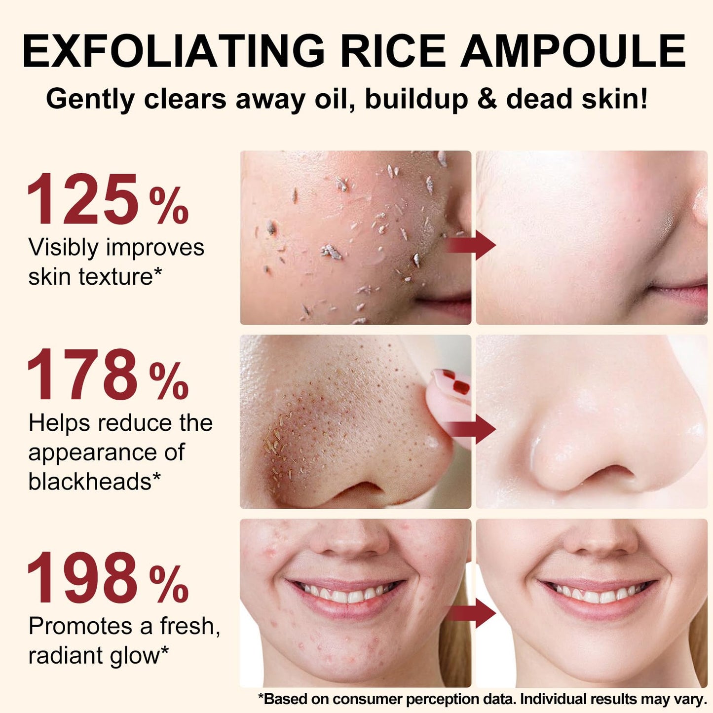 White Rice Exfoliant, White Rice Peeling Glow Ampoule, Peel Shot Glow Exfoliating Face Serum, Korean Skin Care Soft Exfoliating Body Scrub Dead Skin Cells, Blackheads Remover For All Skin Types 100ml