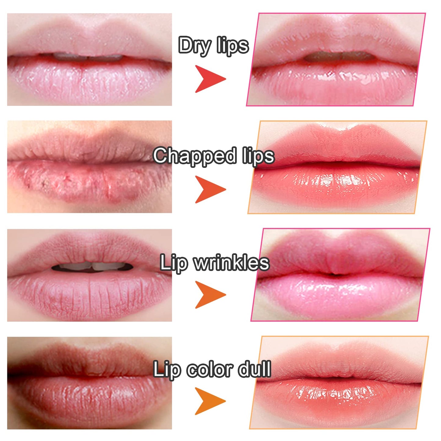 Adofect 30 Pieces Collagen Crystal Lip Masks, Collagen Lip Pads Great for Moisturizing, Remove Dead Skin, Anti Chapped & Anti-Aging and Plump Your Lips, Watermelom Red