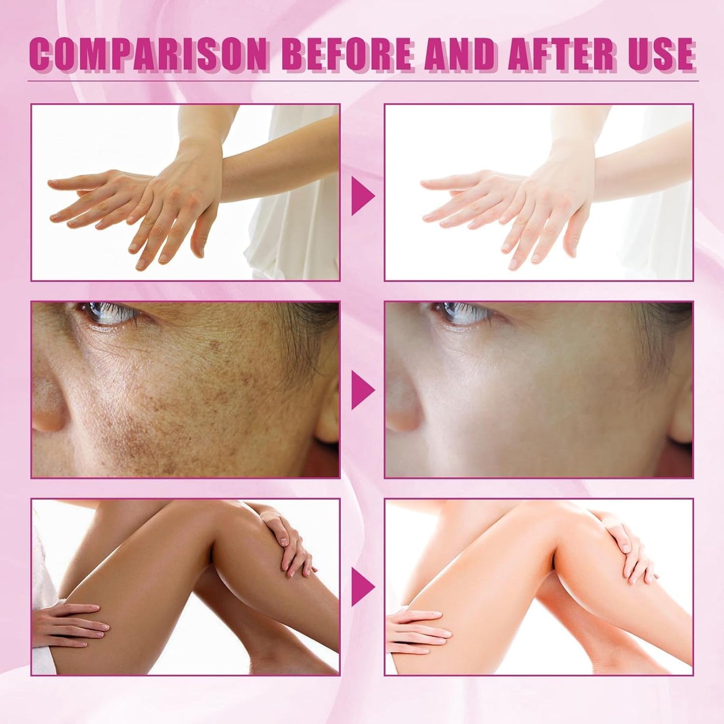 Generic Extra Strong Peeling Oil, Peeling Oil for Dark Skin, Yellow Peeling Oil, Exfoliating Peeling Solution for Hand Feet, Chemical Peel for Face, 110ML / 3.88 OZ (1 PCS)