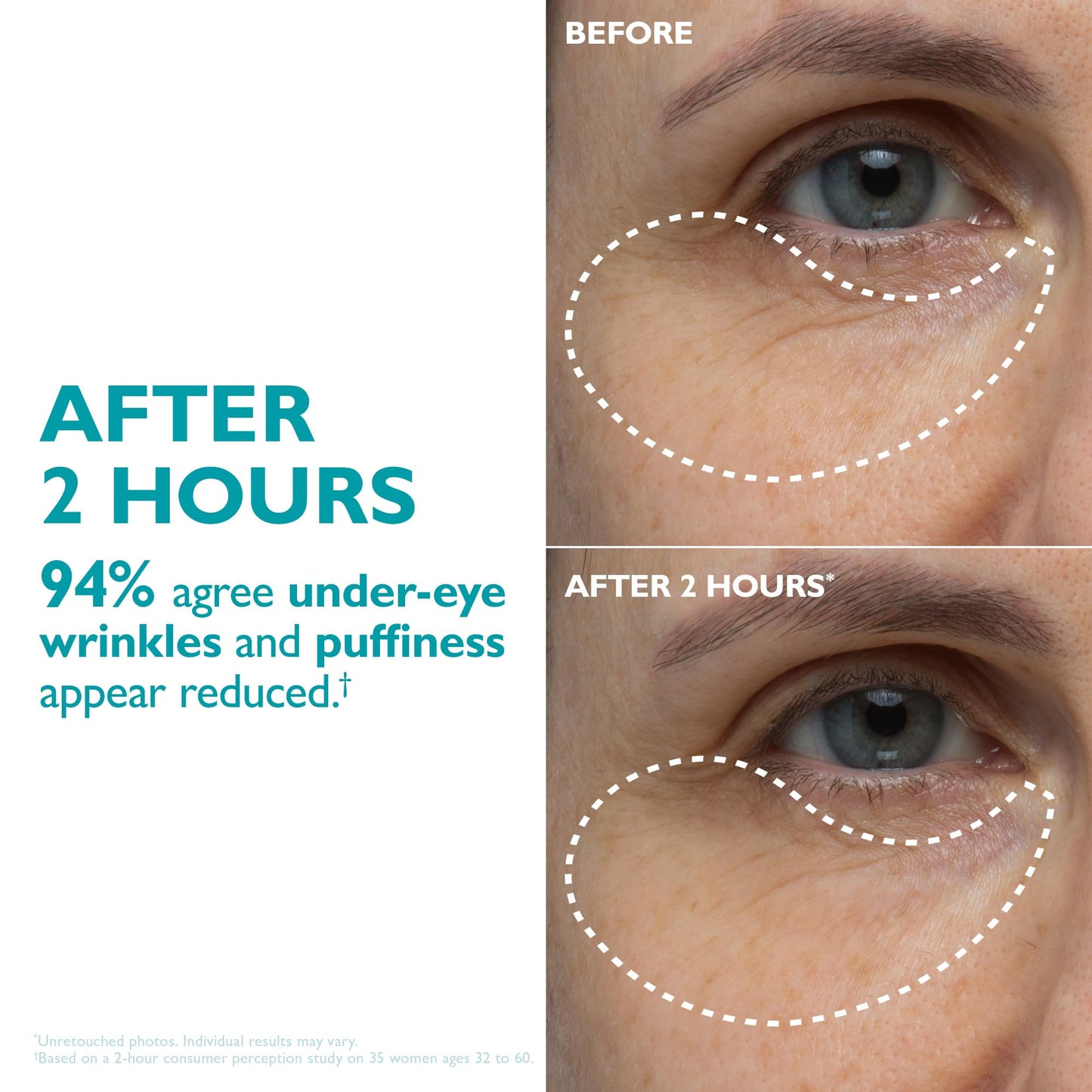 Peter Thomas Roth | Peptide Skinjection™ Peptide-Infused Face & Eye Tape | Face Tape For Wrinkles and Aging Skin | Peptide Face Tape