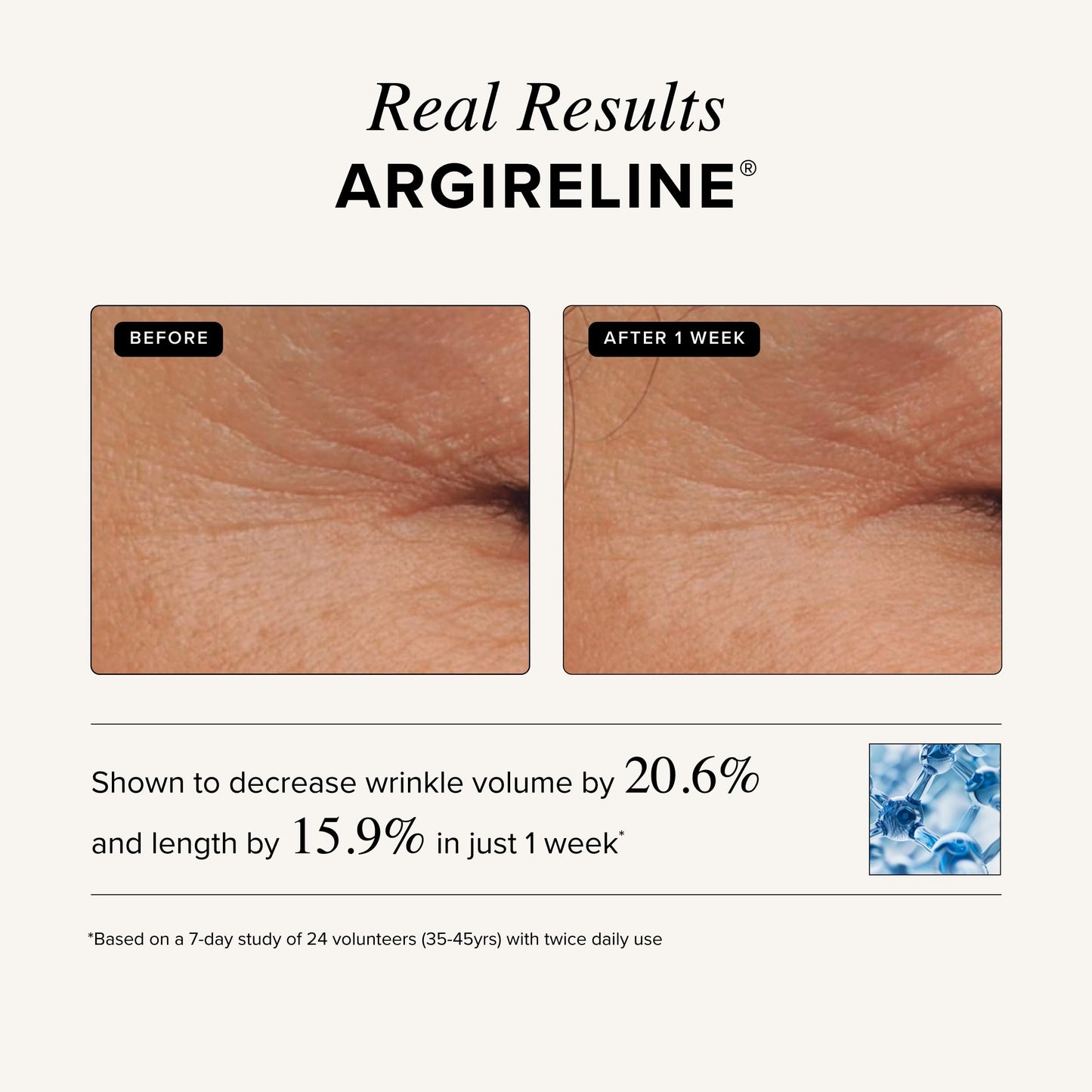 Asterwood Matrixyl 3000 + Argireline Serum for Face - Multi Peptide Serum with Hyaluronic Acid - Anti-Aging, Wrinkle Reducing, Collagen Boosting - Fragrance-Free - 8 Fl Oz