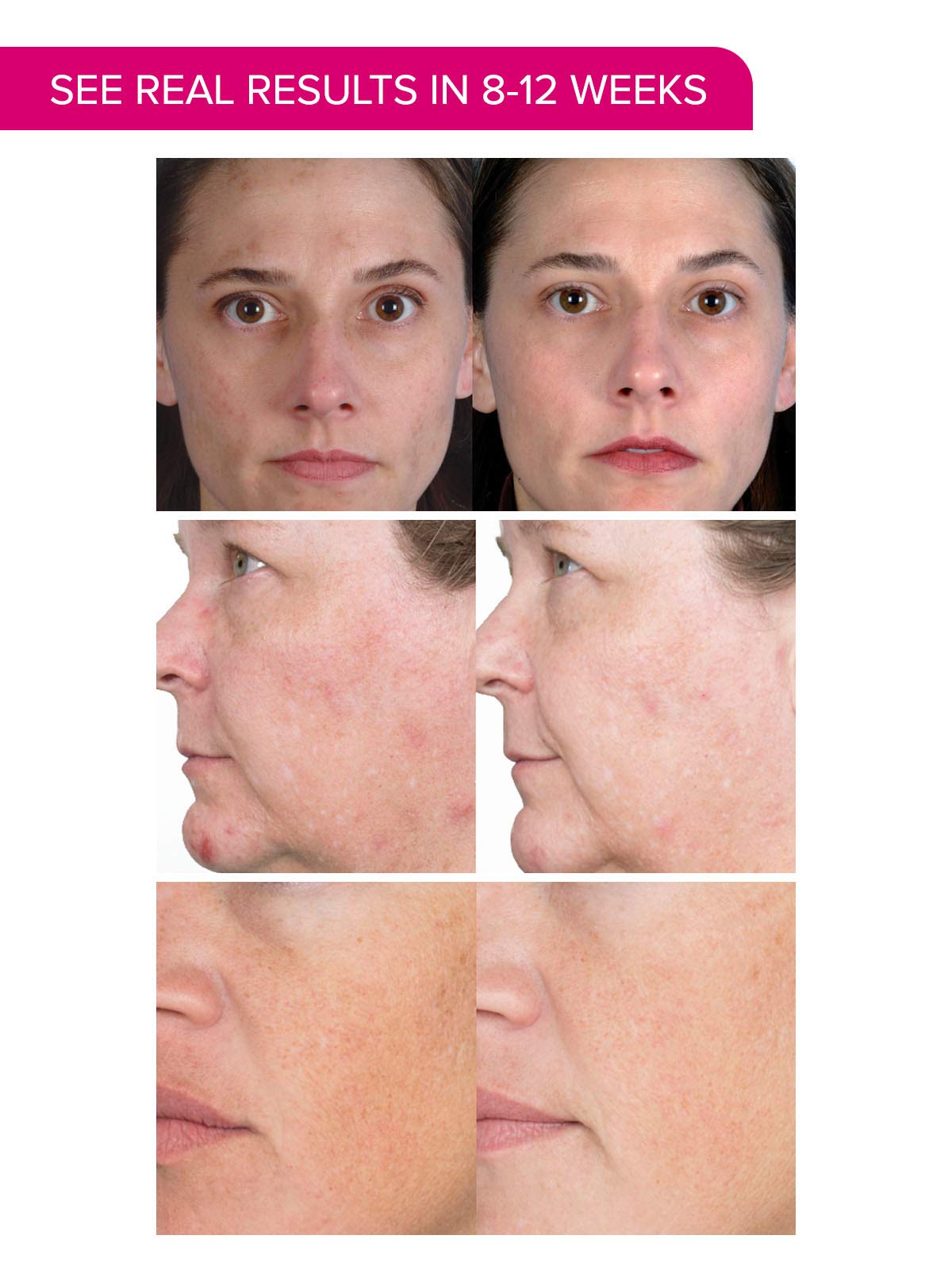 PMD Personal Microderm Plus with Daily Regeneration System