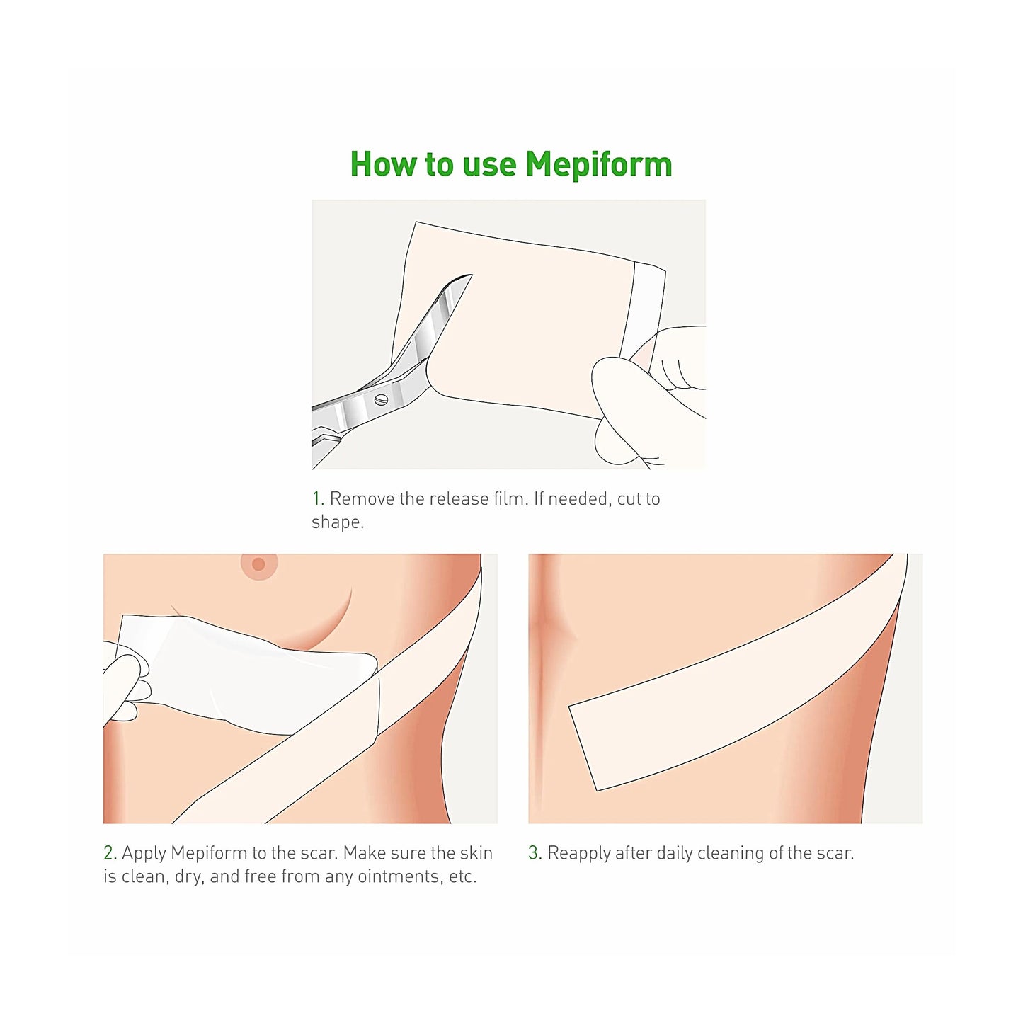 Mepiform 5x7.5 cm bandage 5 pcs