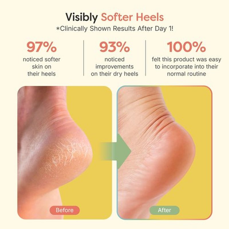ZenToes Moisturizing Sleep Socks with Vitamin E, Olive Oil and Jojoba Seed Oil to Soften and Hydrate Dry Cracked Heels (Fuzzy Lilac Purple, Regular)