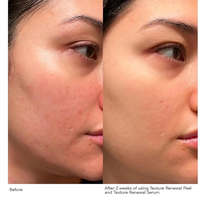 Dr. Dennis Gross Advanced Retinol Serum - Anti-Aging Formula to Smooth Texture & Minimize Fine Lines | 1 oz