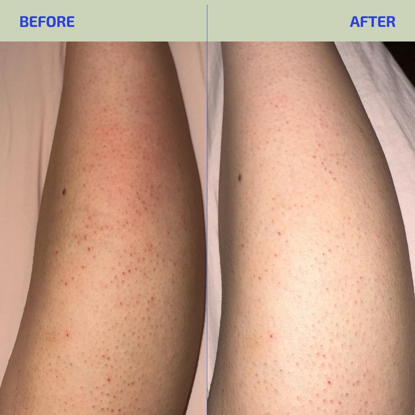 Codex Labs Eczema Relief Lotion with Colloidal Oatmeal, 3.4 oz