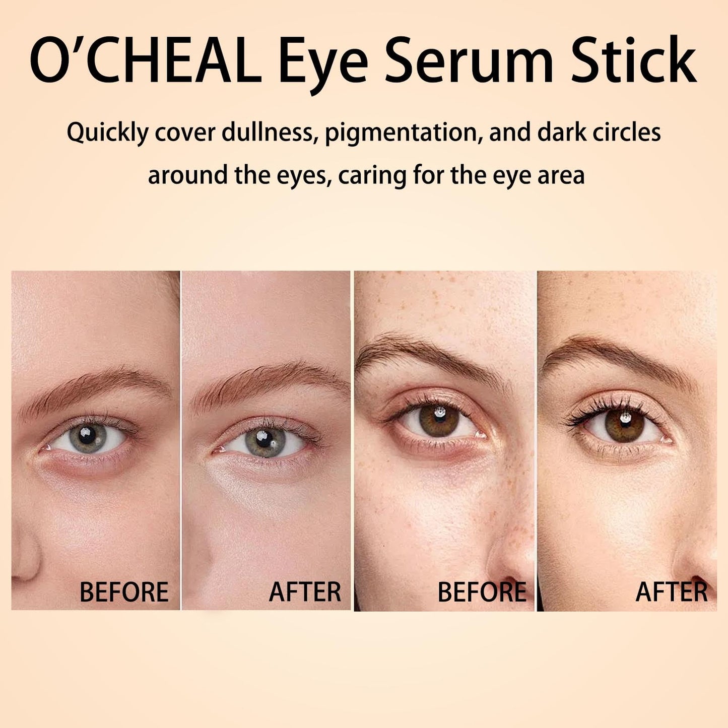O'CHEAL Eye Serum Stick, Hydrating, Nourishing, Brightens, Tightens, Reduces Dark Circles & Eyes Pigmentation, Improves Dullness, Bags Remover Under Eye Cream, Lifts and Firms Skin, Easy to Absorb