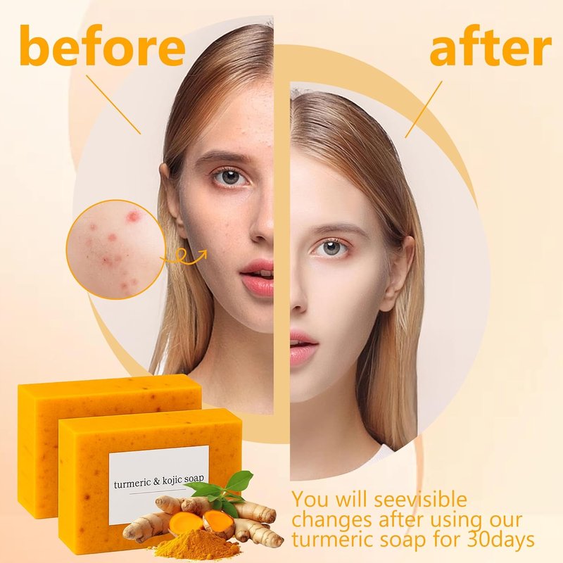 Lemon Soap with Vitamin C & Collagen - Moisturizing for Face & Body | 4 Bars
