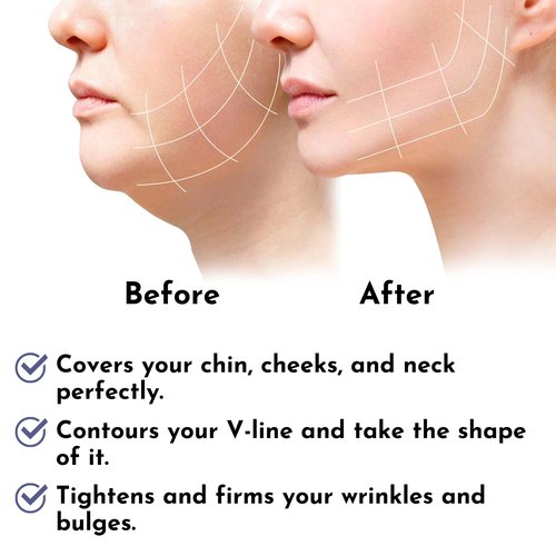Post Surgery Facial Compression Neck Coverage Chin Strap, V-Shaped Face Slimmer, Jowl Tightening Chin Lifting Double Chin Reducer Band (S/M, Black)
