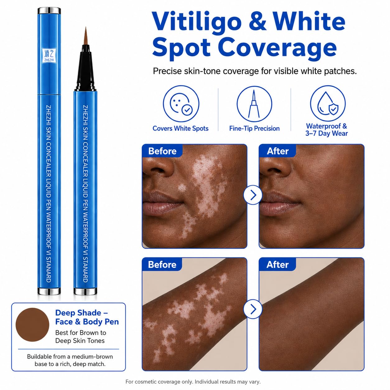 ZHEZHI Vitiligo Concealer Pen 3.5g Waterproof 3-7 Days Face Body Hands Feet Light Medium Brown Deep Skin Tone Portable Quick Application Travel Gym Work (brown to deep skin tone, Face and Body)
