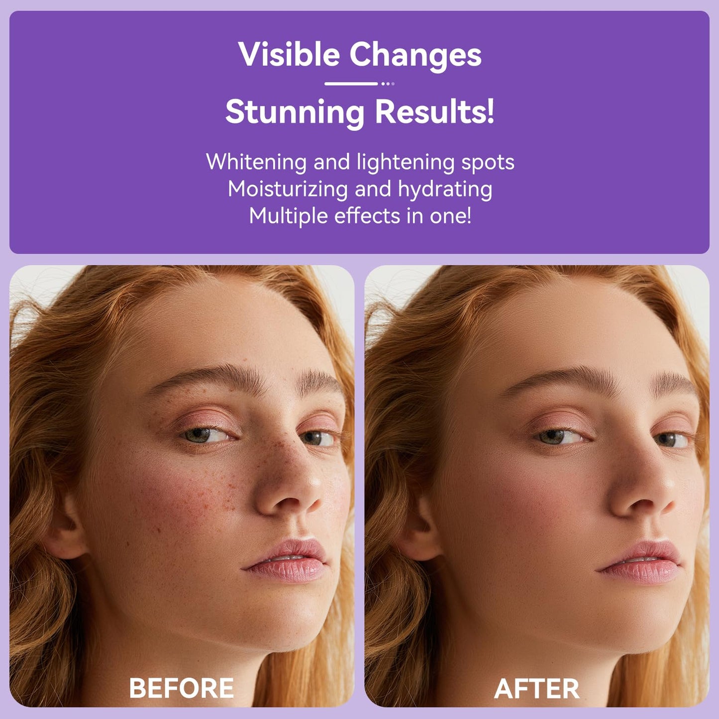 Dark Spot Remover for Face Body and Hands, Dark Spot Corrector for Melasma Age Spot Sun Spot, Brown Spot Remover for Women and Men with 360° Roller - 0.67 floz
