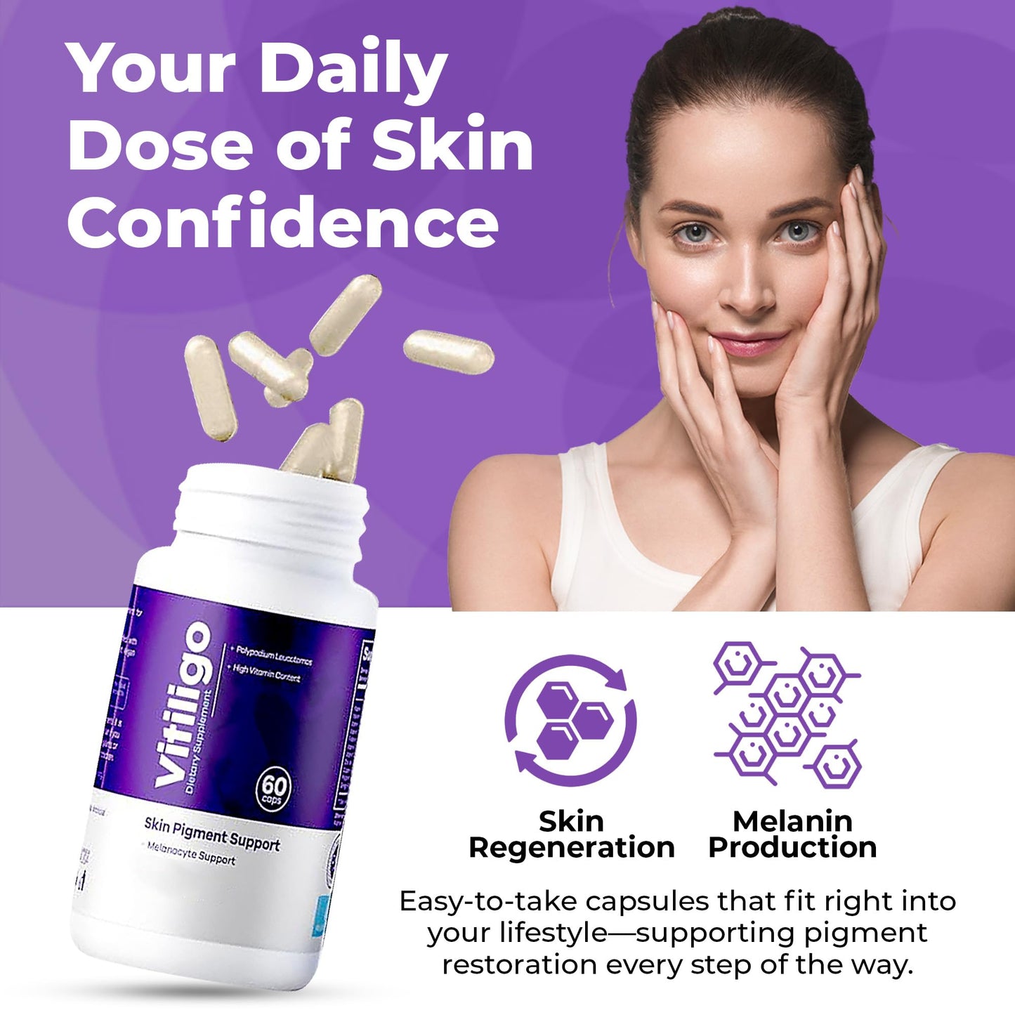 AURA VITAMINS - Vitiligo Capsules 60 Count | 1 Month | Improve Skin Pigmentation Support and Reduce White Spots | Effective Vitiligo Supplement | Natural Solution for White Spots on Skin. (1)