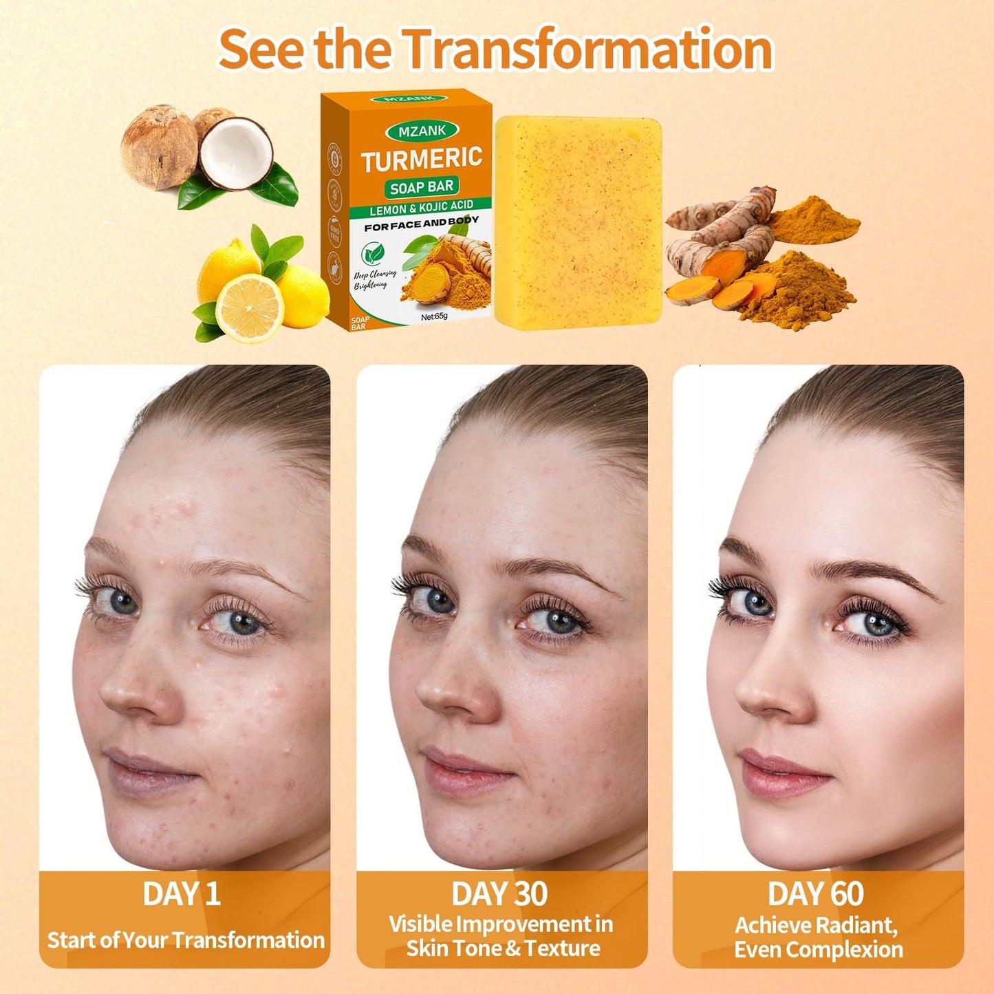 MZANK 2 Pack Kojic Acid Soap,Dark Spot Remover Turmeric Soap Bars Moisturizing with Collagen,Vitamin,Hyaluronic Acid,Retinol,Shea Butter,Tumeric Soaps for Face Body All Skin Types
