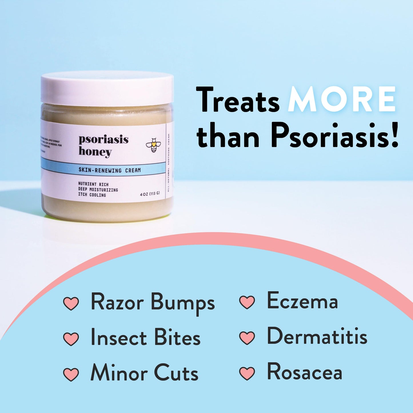 PSORIASIS HONEY Skin-Renewing Cream - Eczema & Seborrheic Dermatitis Cream - Psoriasis Treatment for Skin, Redness & Itch Relief (4oz)
