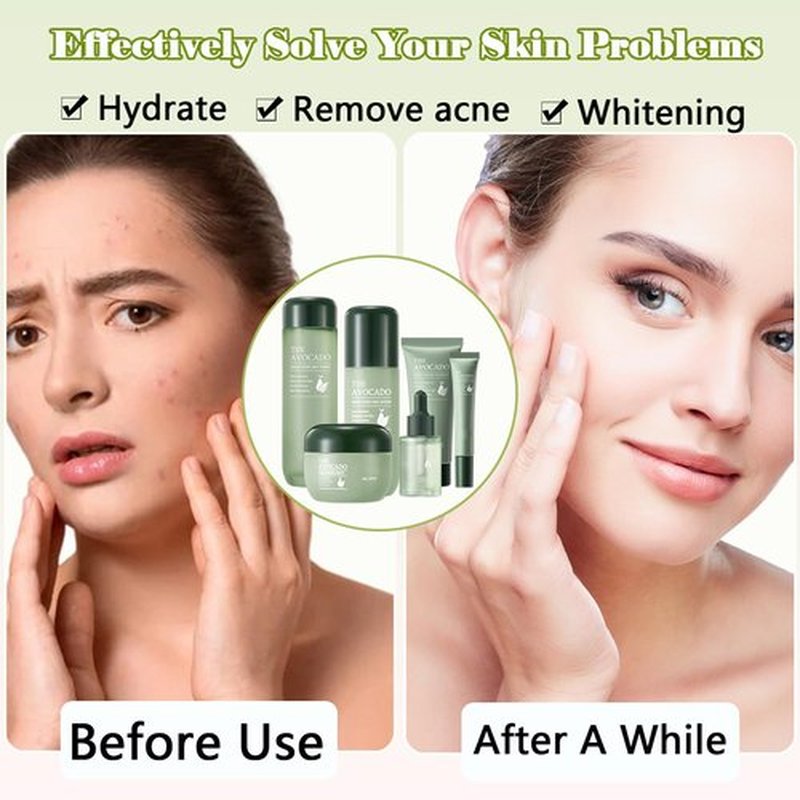 Avocado Skin Care Set for Women,6PCS Skincare Kits with Facial Cleanser, Toner, Serum, Lotion,Cream, Eye Cream, Moisturizing Korean Skin Care Set,Anti-Aging Skin Care Set,Face Care Gift Set for Women