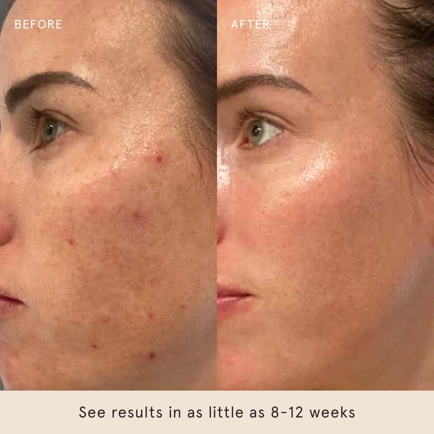 Barefaced Retinal Skin Therapy 30ml - Retinaldehyde & Bakuchiol Serum for Firming, Reducing Fine Lines & Wrinkles, Improving Skin Tone & Texture w/Shea Butter, Jojoba Oil & Argan Oil