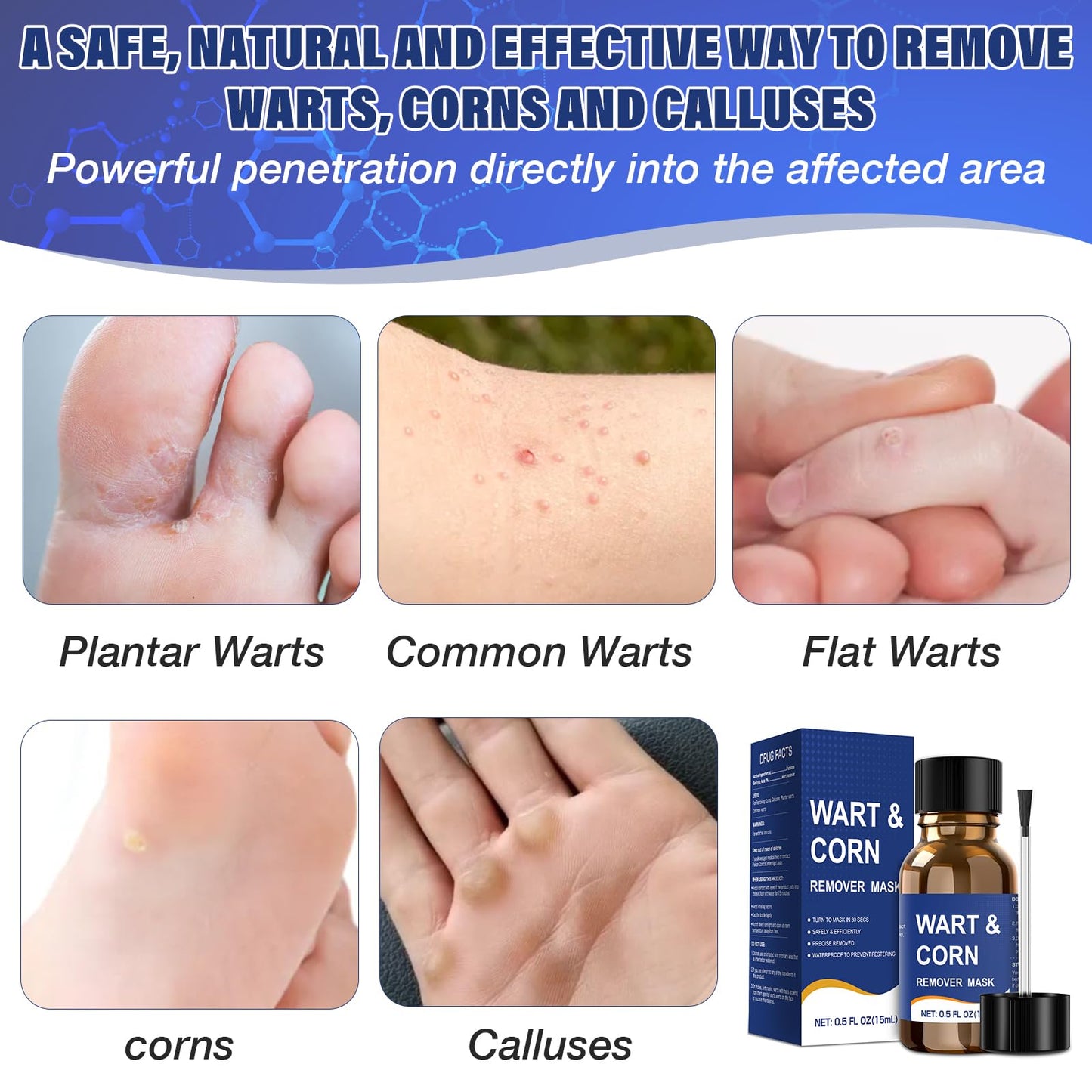 Wart Remover Liquid with Salicylic Acid for Feet and Hands, Plantar Wart and Corn Remover Freeze Off Formula, Fast Acting Treatment for Common Flat Warts, Corns and Calluses 15 ml (0.5 fl oz) 3 pack