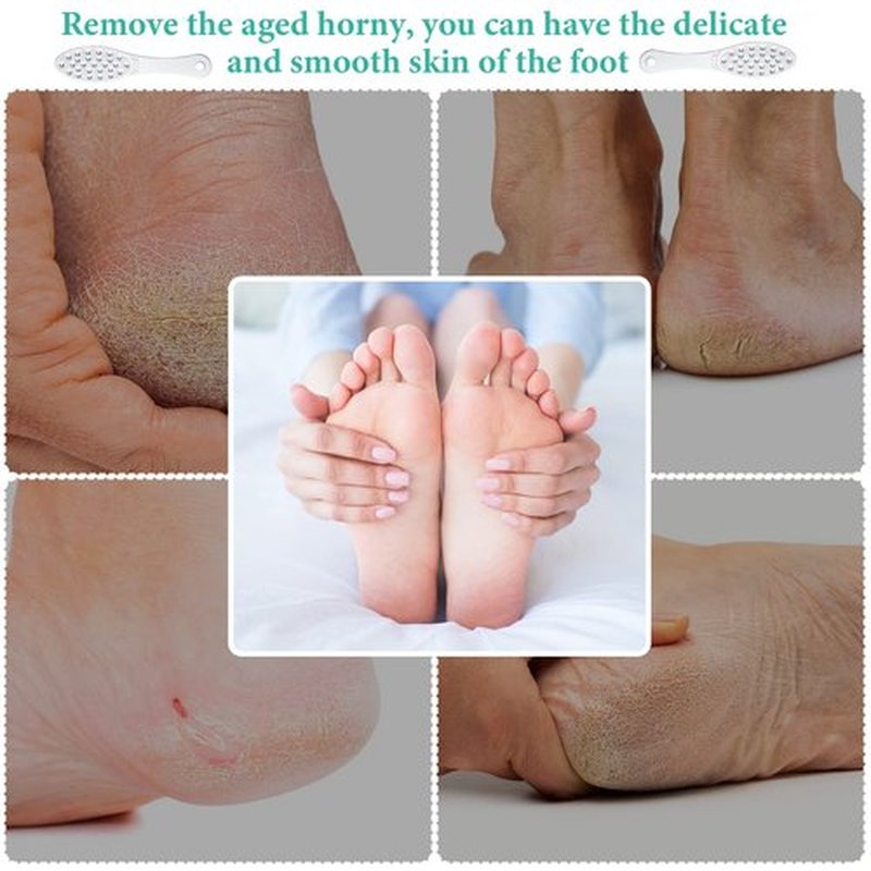 Jutom 1 Pc Stainless Steel Foot Scraper Metal Foot File Double Sided Foot File Callus Remover Professional Foot Rasp Scrubber for Wet or Dry Skin Easy to Clean Pedicure Tool Heel