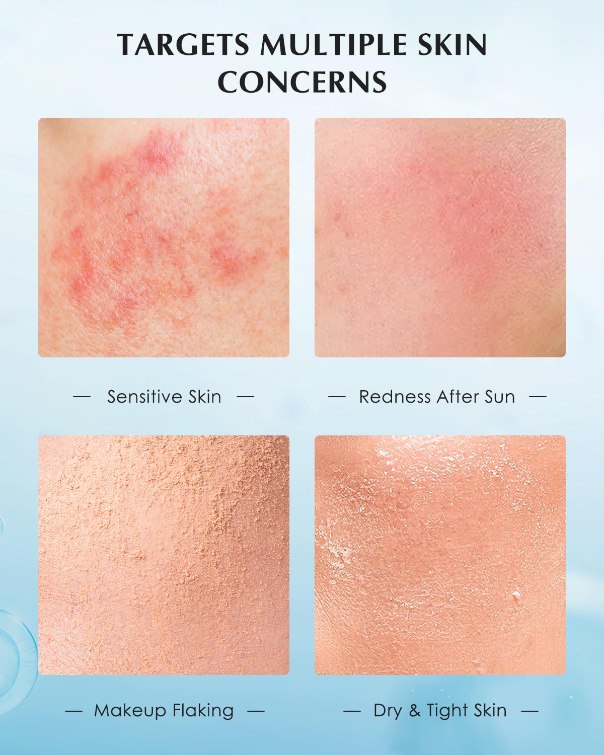 KOMFYMED Recombinant Collagen Essence – Barrier Repair Serum for Sensitive Skin, Redness Relief & Deep Hydration (1.5ml / 0.05 fl.oz × 30 Single-Use Ampoules)
