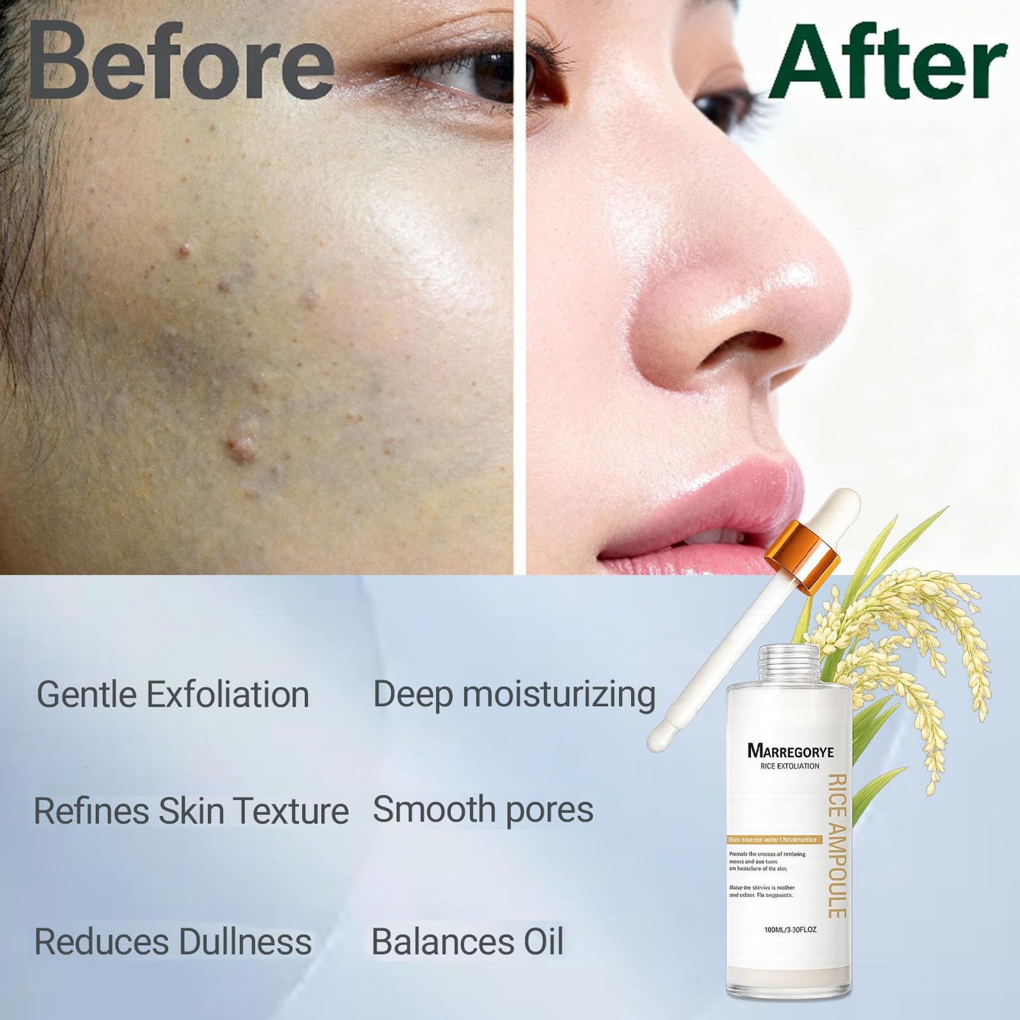 MARREGORYE Beauty Peel Shot Glow Rice Ampoule Duo Exfoliating Essence, Black Rice Exfoliant Face Scrub for Hydrating & Blackhead Remover, Body Care 100ml (Rice Exfoliant Essence)