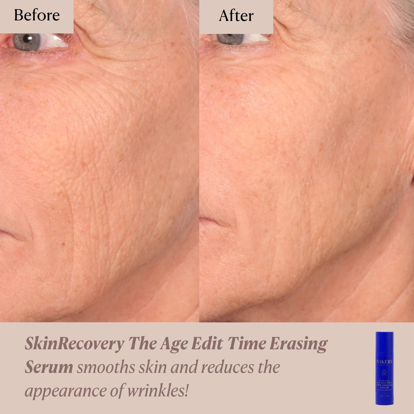 Nakery Beauty SkinRecovery The Age Edit Time Erasing Serum For Face, Anti Aging Exfoliating Serum With Multi Acid Blend And Magnesium, Helps Improve The Look Of Firmness Tone And Texture