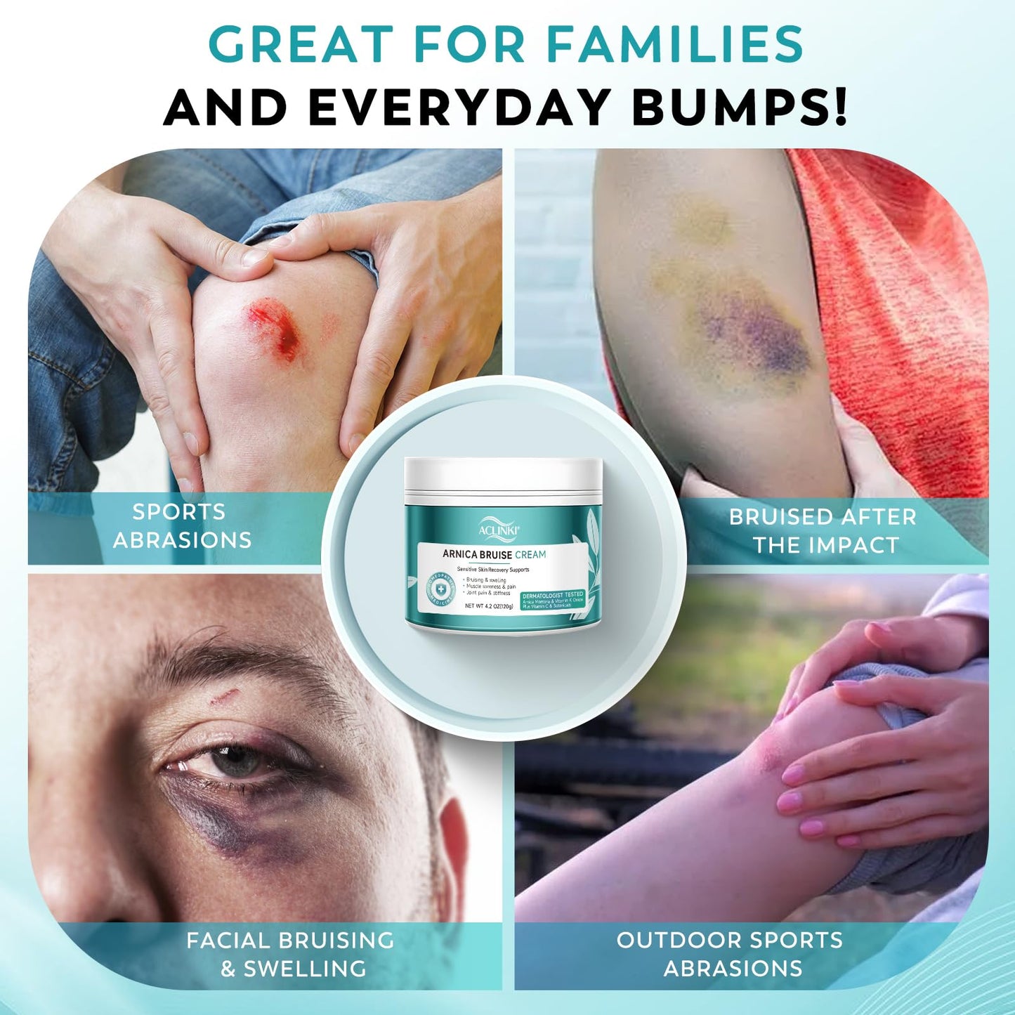 ACLINK Arnica Bruise Cream for Bruising & Swelling Relief, Arnica Montana with Vitamins K, C & E, Fast Absorbing Non-Greasy Moisturizing Cream for Thin Sensitive Skin on Face,Fragrance Free, 4.2 oz