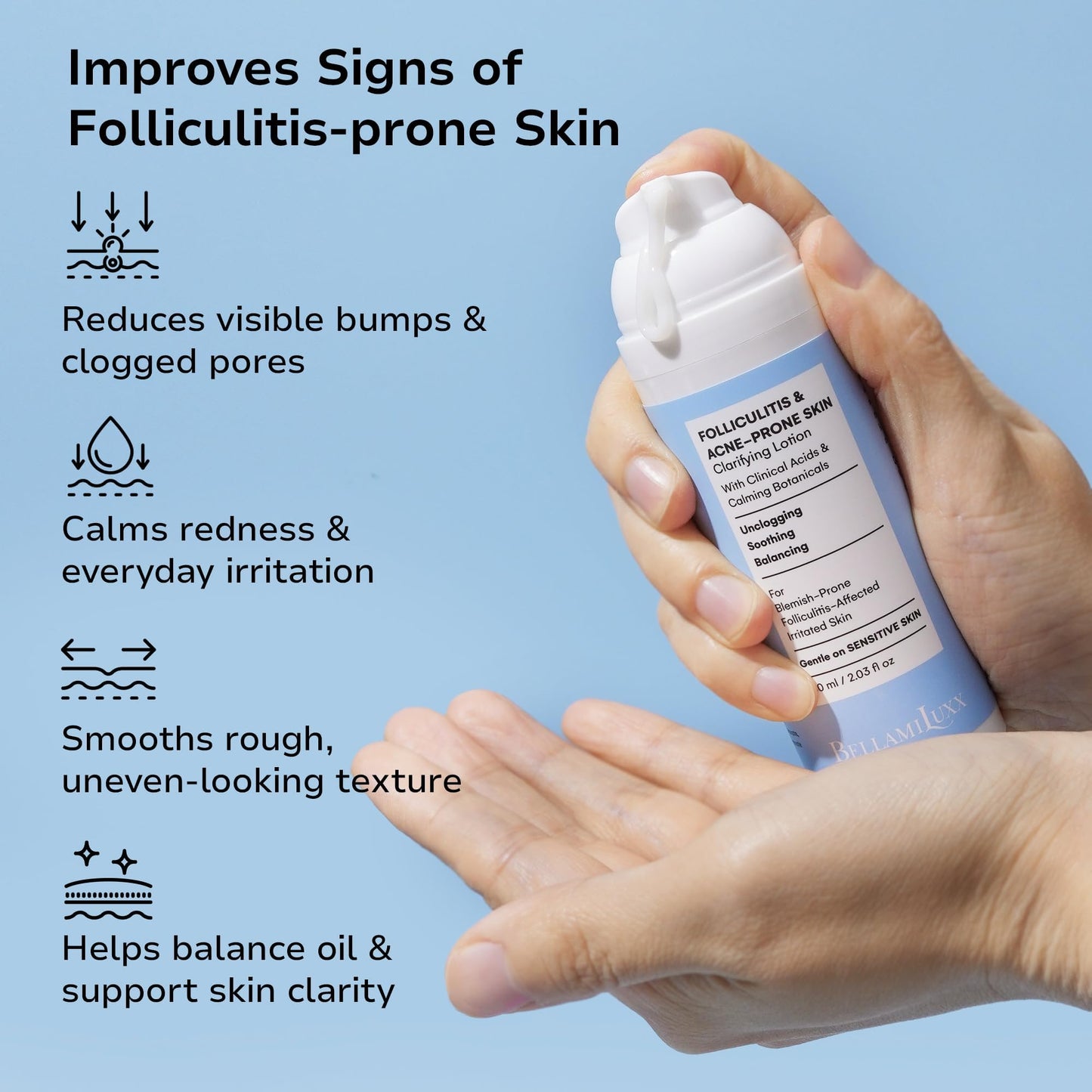 BellamiLuxx Folliculitis Acne Lotion for Body: Helps Reduce Itch, Redness, Body Acne, Bumps & Uneven Texture with Salicylic & Glycolic Acid + Botanicals - Gentle Care for Folliculitis-Prone Skin
