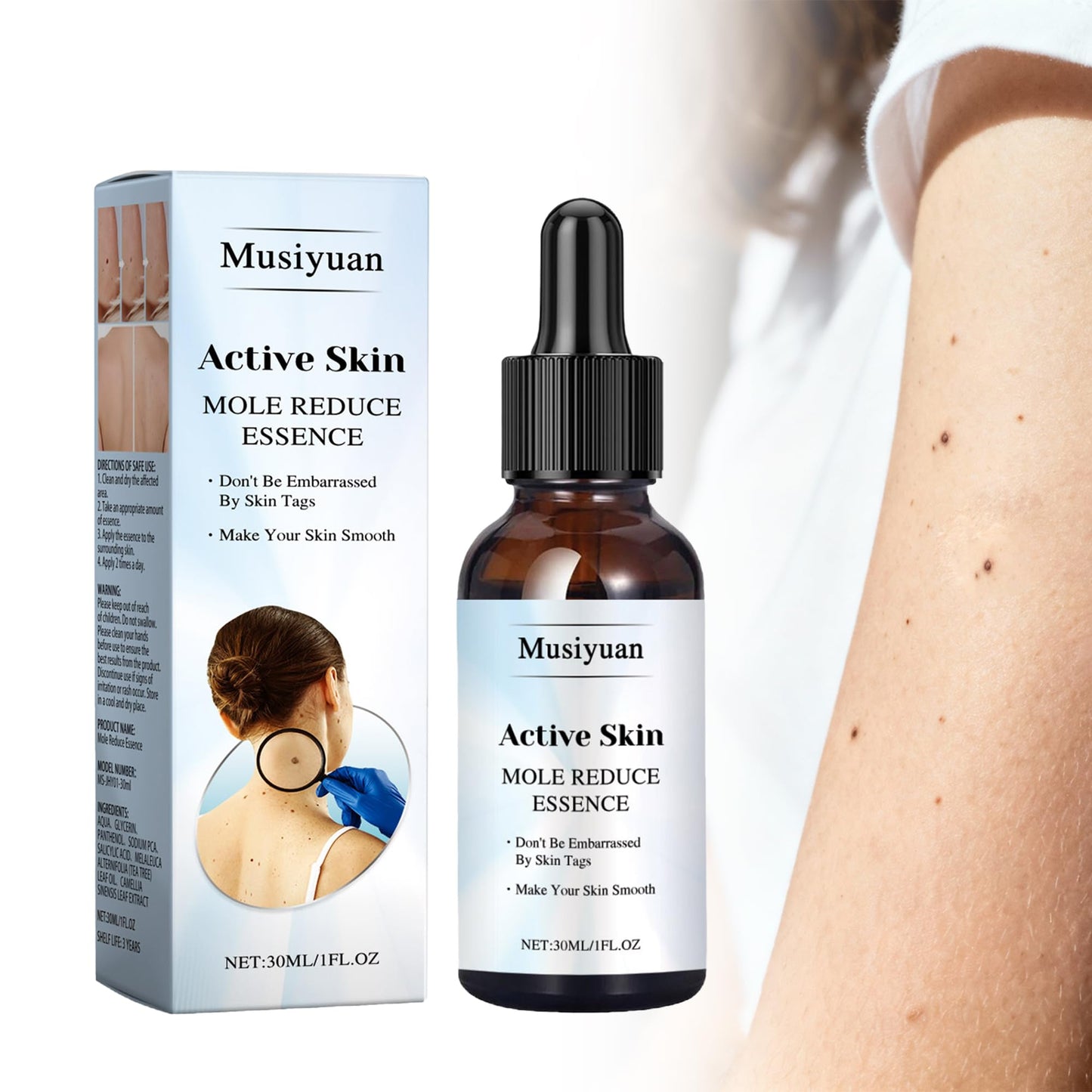 Musiyuan Facial and body mole and skin growth removal serum – fast-acting, precise dropper design effectively removes various warts (30ml)