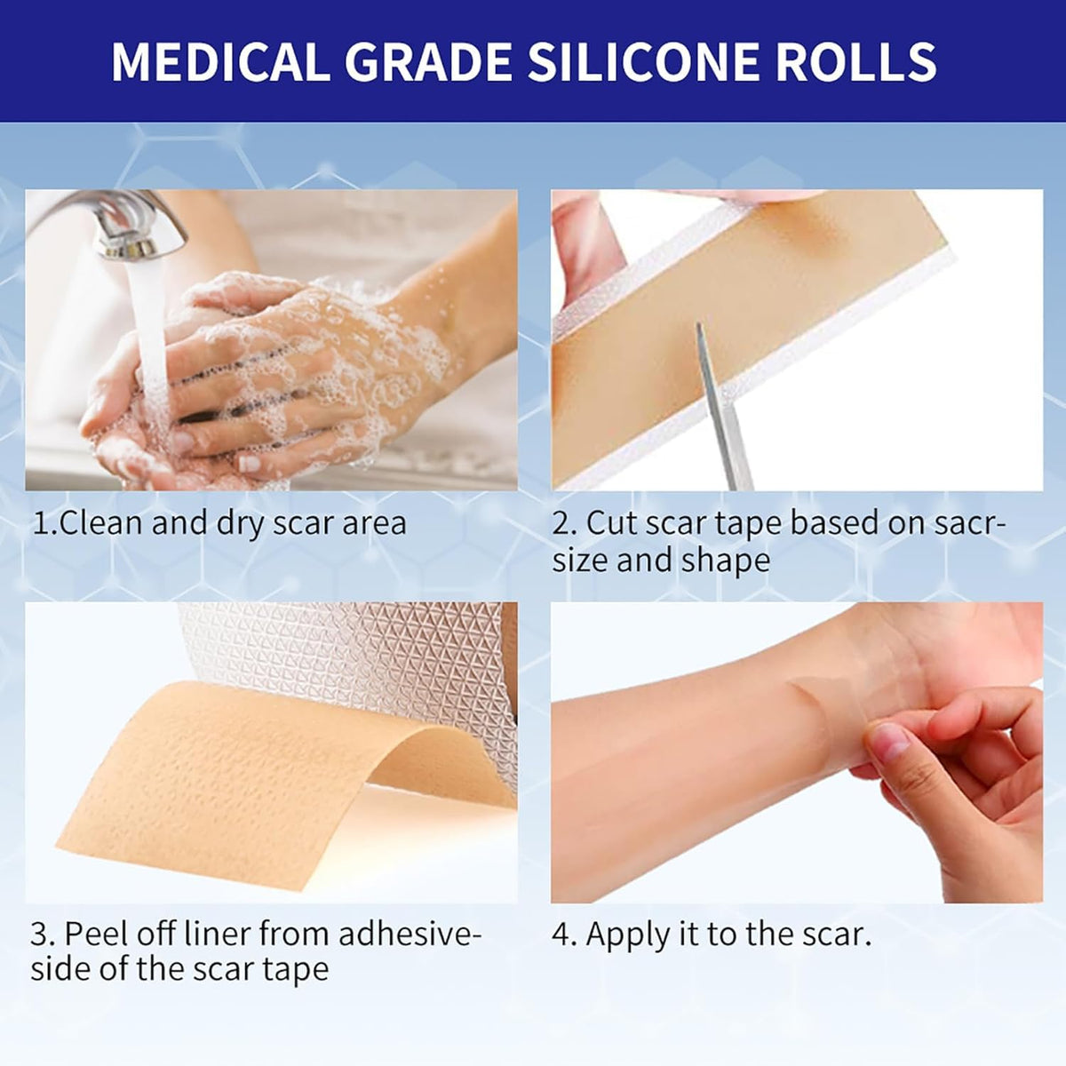 Silicone Scar Sheets 1.6"x39.4" Roll-1M Scars Removal Treatment Medical Grade Silicone Scar Tape for Skin Resuable Strip for Tummy Tuck,Incision,Keloid,C-Section,Burn,Acne Scars(pink)