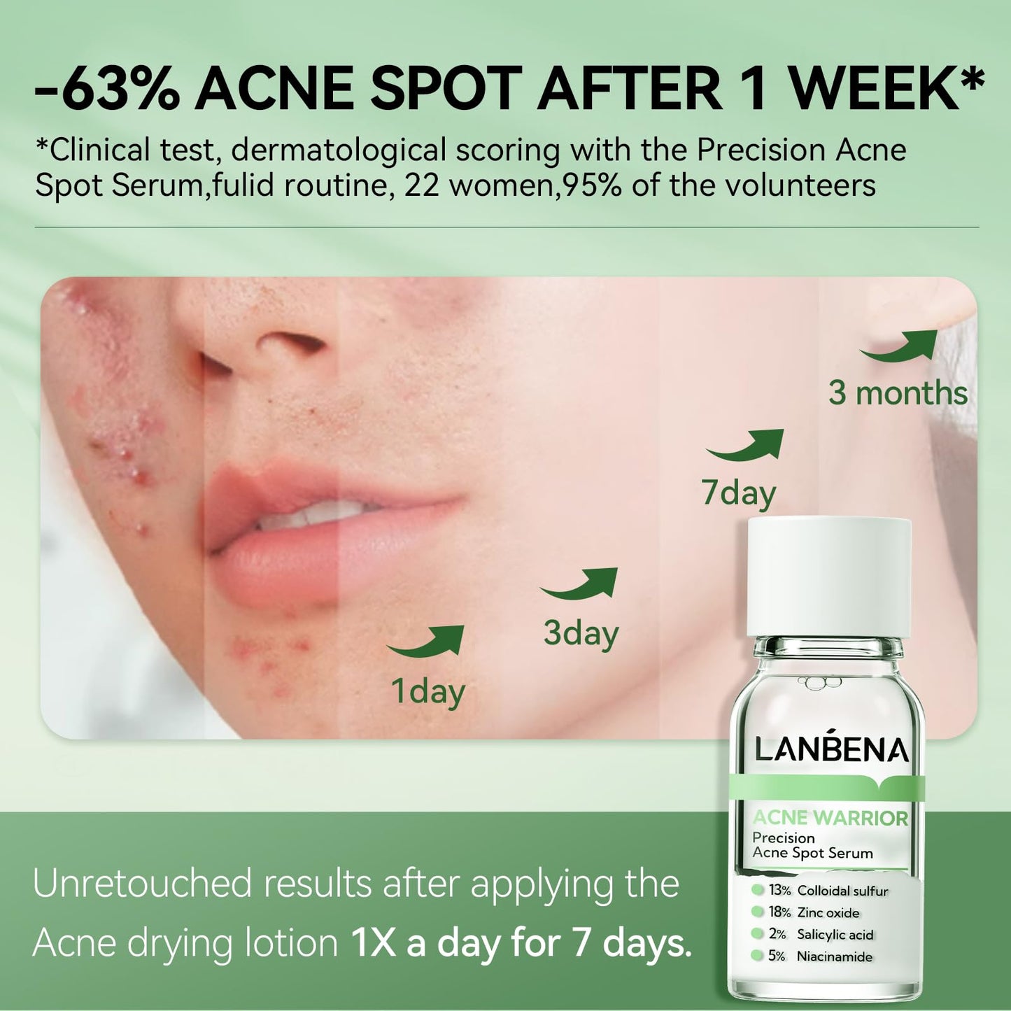 LANBENA Precision Acne Spot Serum, Acne Drying Lotion, Overnight Acne Treatment For Face, Dry Out Pimples, Blemishes, Zits And Clean Pores, 0.43 Fl Oz