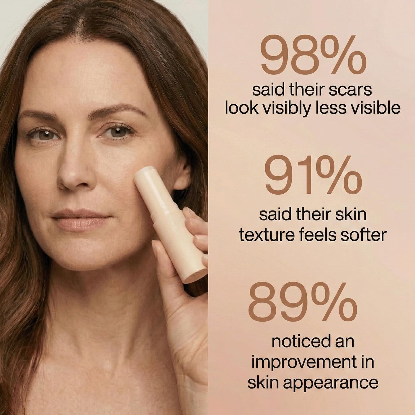 Pluune Scar Stick, Suitable for Old Scars, Acne Marks, and Stretch Marks,Formula Infused with Centella Asiatica Extracts and Vitamin E Soothes, Repairs and Forms Protective (1PCS)