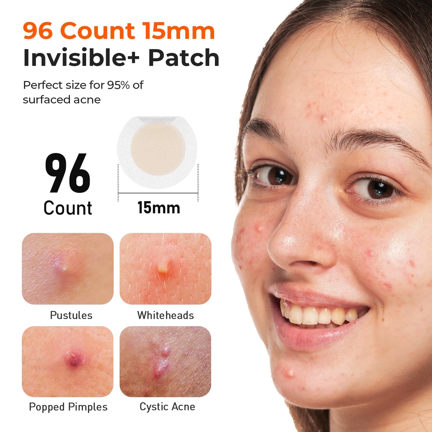 Pimple Patches, 15 mm Invisible Acne Patches for Face with Salicylic Acid, 0.01cm Extra Thin Outer Edge, Hydrocolloid Zit Patch for Pustule, Whitehead, Cystic Acne Spot, 96 Count