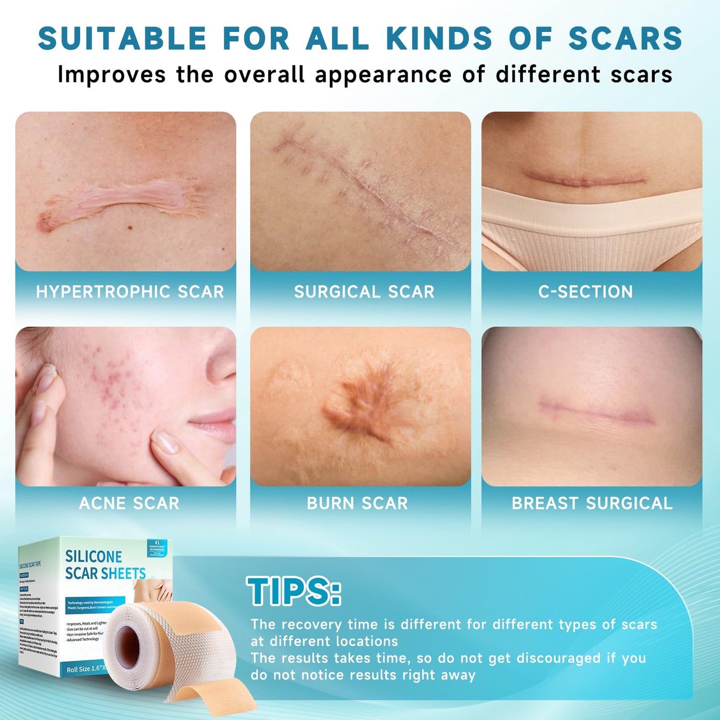 Rvlaim Medical Grade Silicone Scar Sheets (1.6”x 60” Roll-1.5M), Professional Silicone Scar Tape for Surgical C-Section, Keloid, Burn & Acne Scars - Reusable, Waterproof, Stickiness Upgrade