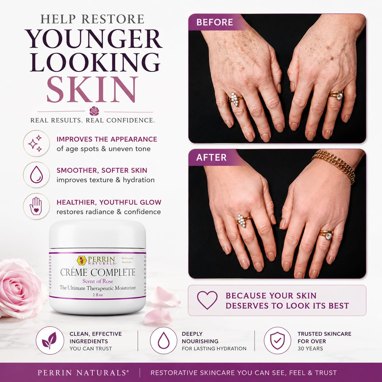 Perrin Naturals Crème Complete, Lichen Sclerosus treatment Cream for Dry Sensitive Skin, Restorative Anti Aging Face & Body Moisturizer with Barrier Support for Women, Scent of Rose, 2 oz
