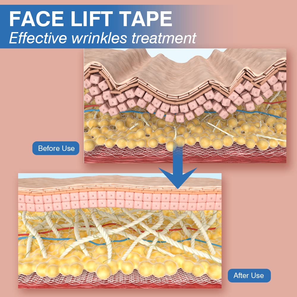 Sfuchin Face Tape for Wrinkles - Face Wrinkle Tape - Facial Smoothing Patches - V Face - Self Care Products - Forehead Wrinkle Patches Reusable - Chest Wrinkles - Neck Patches - 2.5CM*1000CM