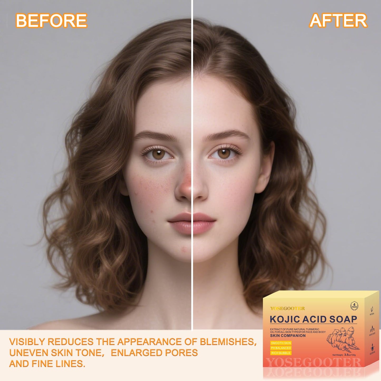 YOSEGOOTER Turmeric Kojic Acid Soap Bars, Face&Body Dark Spots Remover, Turmeric Soap Bar for Dark Spots Brightening & Moisturizing with Collagen, Vitamin E, Retinol, Hyaluronic Acid, Shea Butter