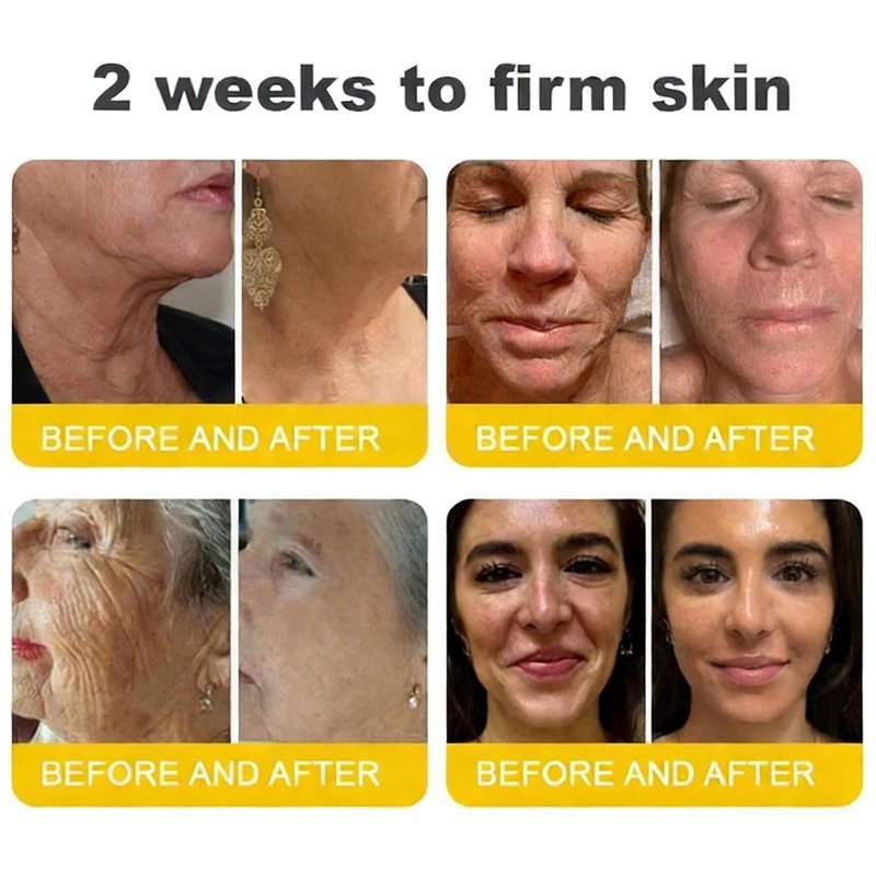 Wrinkle-Lift Tightening Cream - Botoxmix & Vita A Retinol Shot for Youthful Skin | Deep Moisturization (1PC)