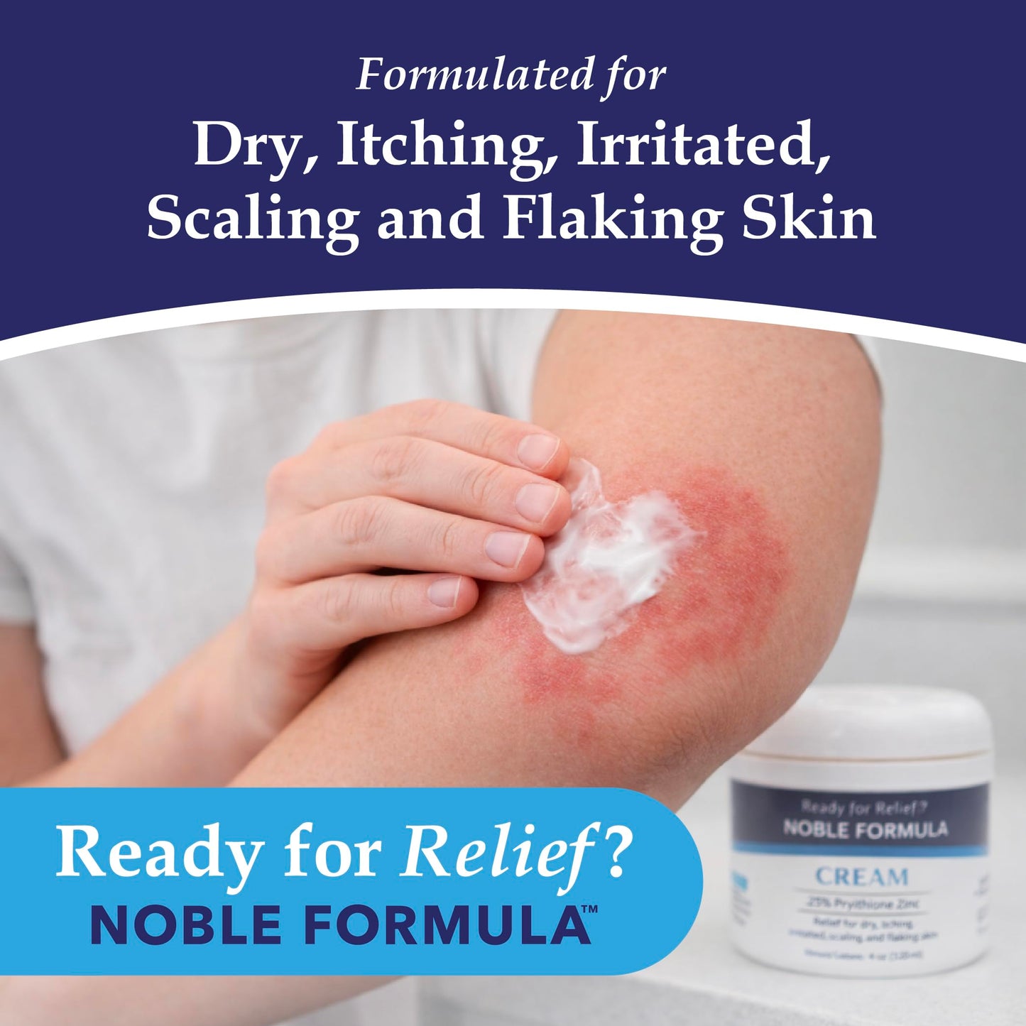 Noble Formula Pyrithione Zinc Cream 0.25% – Moisturizing Cream for Itching, Flaking, Dryness & Redness – Skin Support with Rosehip Oil, Squalane, Sweet Almond Oil & Vitamin E - 4 oz