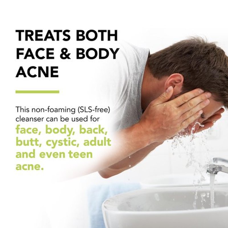 humane Benzoyl Peroxide Acne Body Wash - 5% Regular-Strength Acne Treatment for Face, Skin, Back and Body - 16 Fl Oz - Dermatologist-Tested Non-Foaming Cleanser - Vegan, Cruelty-Free