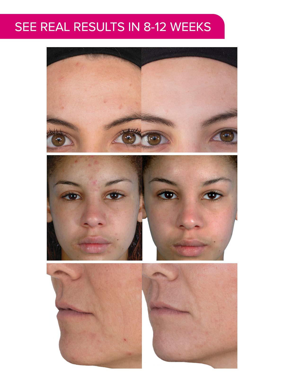 PMD Personal Microderm Plus with Daily Regeneration System