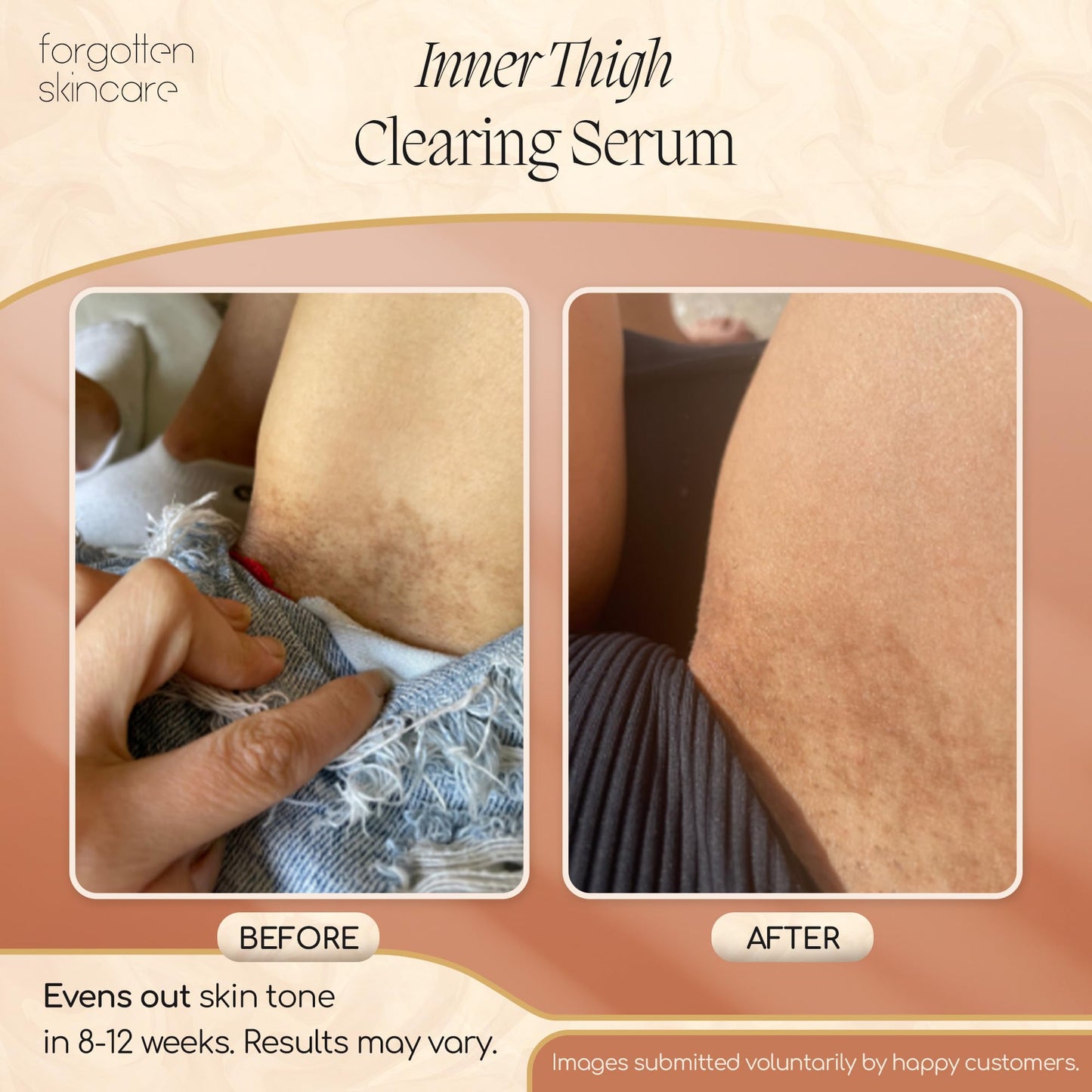 Forgotten Skincare Body Oil Serum - Hydrating Treatment to Soothe Razor Bumps, Ingrown Hair Treatment & Support Even Skin Tone